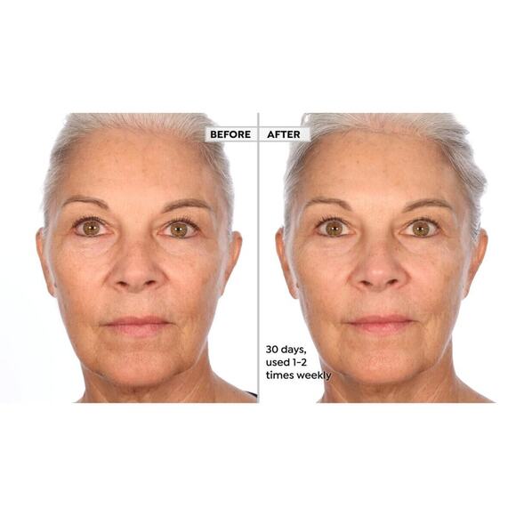 Active Argan Resurface Accelerating Peel Activated Argan Complex, 1.0 fl oz. New - Picture 3 of 16